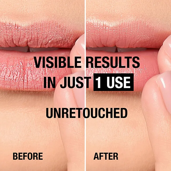 Neutrogena Norwegian Formula Intense Repair thumbnail 4