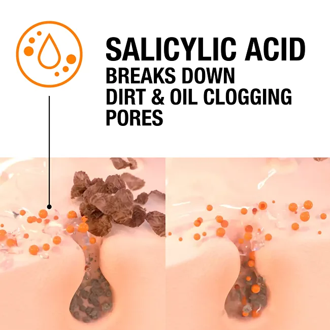 Neutrogena Blackhead Eliminating 2% Salicylic Acid Face Scrub thumbnail 5