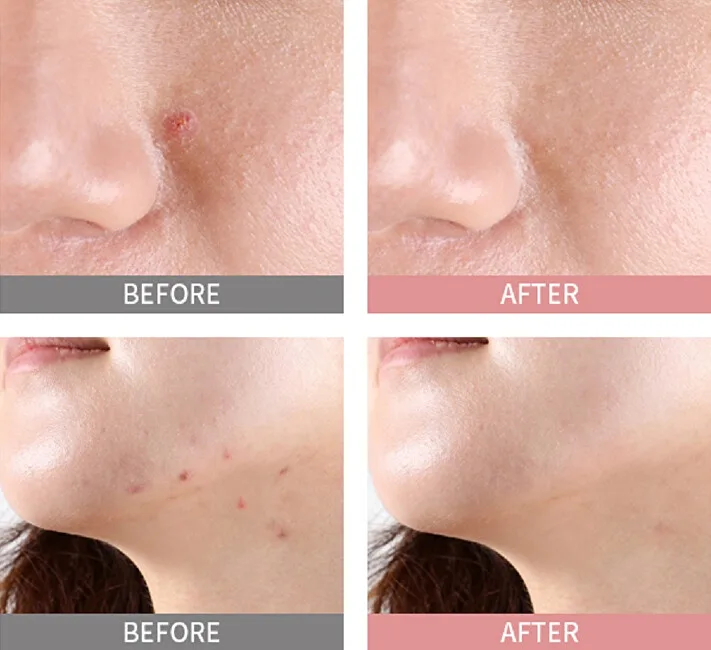 Mizon Pink Spot Good Bye Blemish (Overnight Spot Care ) Night Serum 19 ml thumbnail 4