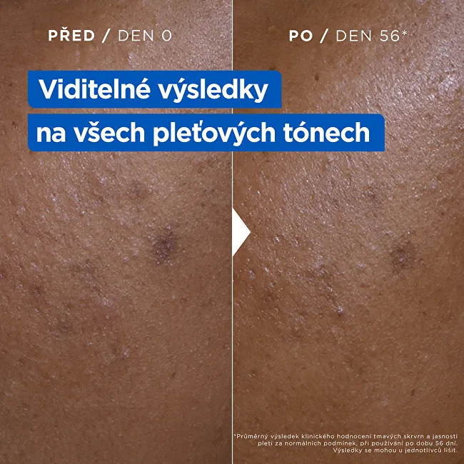 Mixa Niacinamide Bright Moisturizing Anti-Dark Spot Cream thumbnail 3