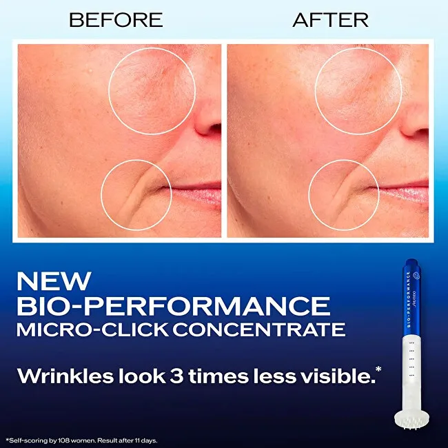Shiseido Pen for mature skin Micro-Click Concentrate Pen 1.4 ml thumbnail 2