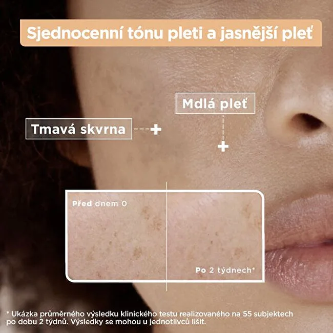 Mixa Vitamin c + glycolic acid anti-dark spot serum thumbnail 3