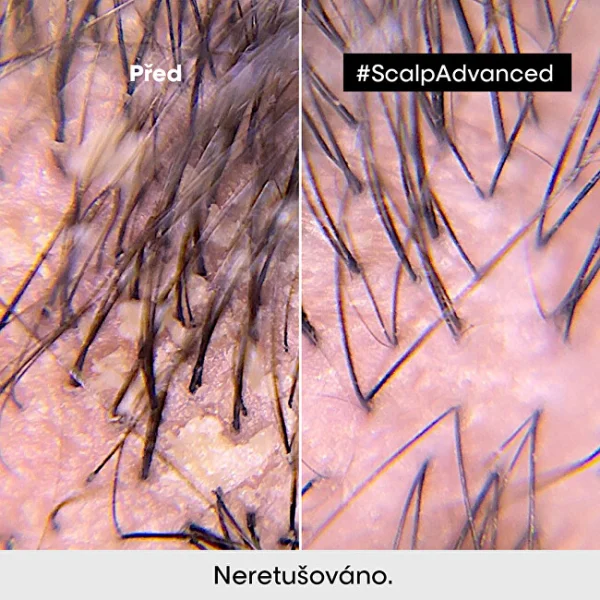 Scalp advanced anti-oiliness professional shampoo thumbnail 4
