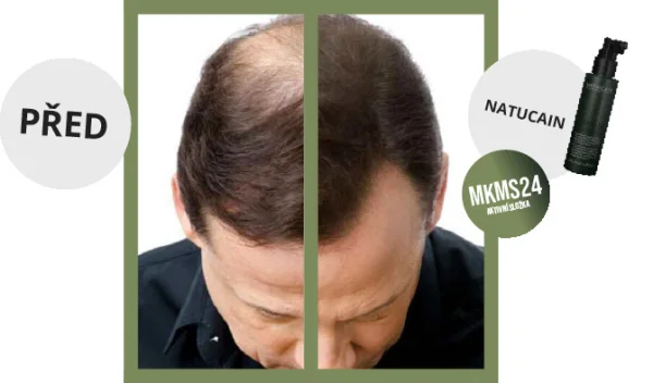 Mkms24 hair activator serum thumbnail 2