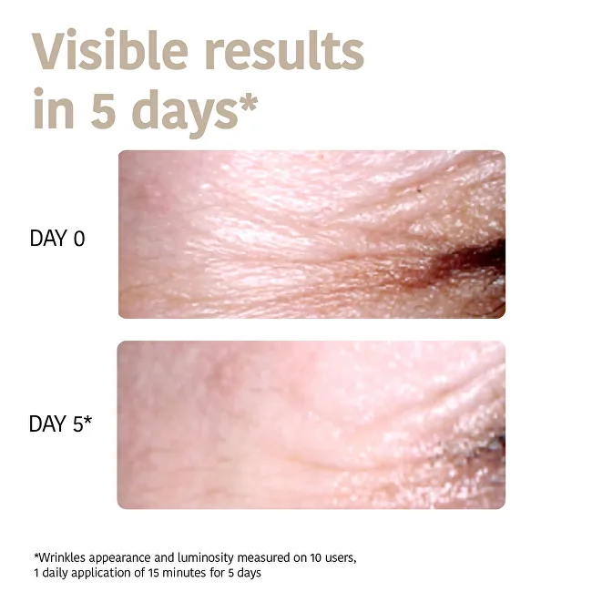 Iroha Anti-aging Eye Contour Patches 2 x thumbnail 3