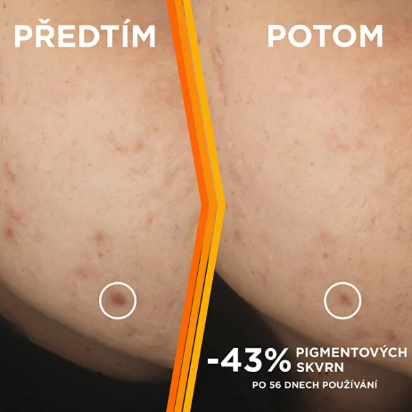 Skin naturals brightening super serum thumbnail 6