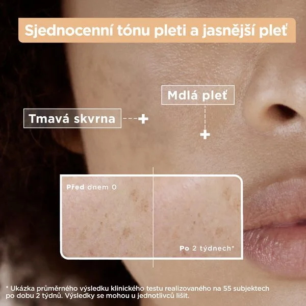 Vitamin c + glycolic acid anti-dark spot serum thumbnail 4