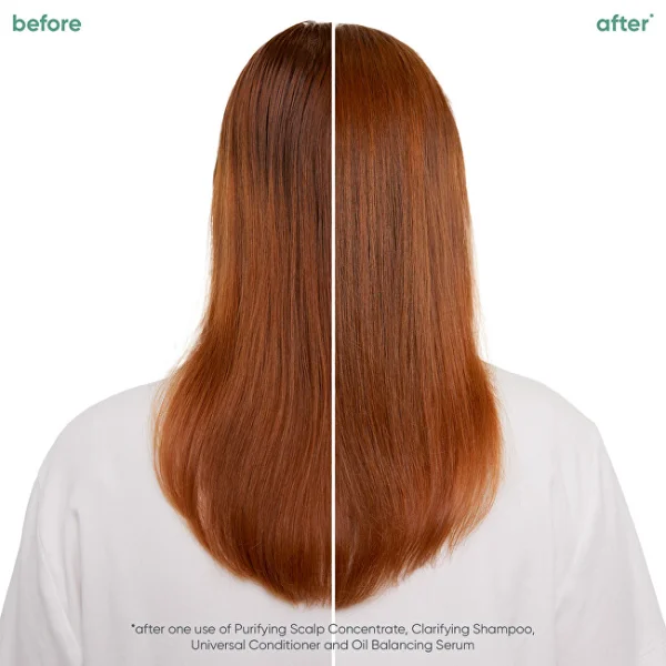 Scalp sync clarifying shampoo thumbnail 3