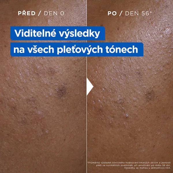 Niacinamide bright moisturizing anti-dark spot cream thumbnail 8