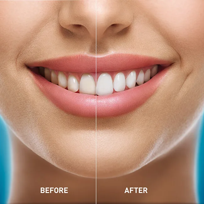 MEDIBLANC Whitening Toothpaste (Whitening Toothpaste) thumbnail 7