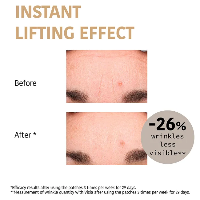 Iroha Forehead Anti-wrinkles Patches thumbnail 3