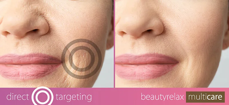 BeautyRelax Cosmetic device Multicare BR-1380 thumbnail 7