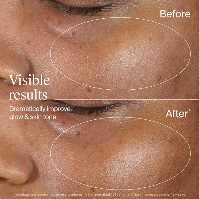Neutrogena Collagen Bank Serum with Vitamin C thumbnail 6