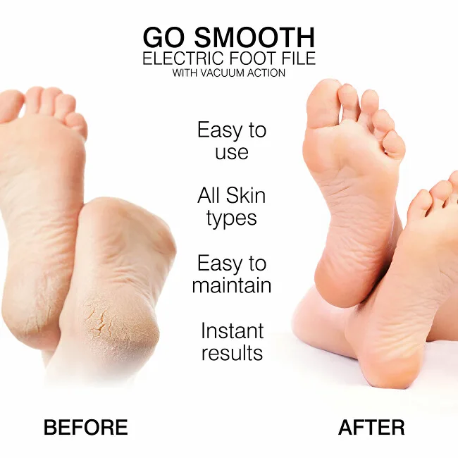 Rio-Beauty Go Smooth electric foot file with vacuum suction thumbnail 3
