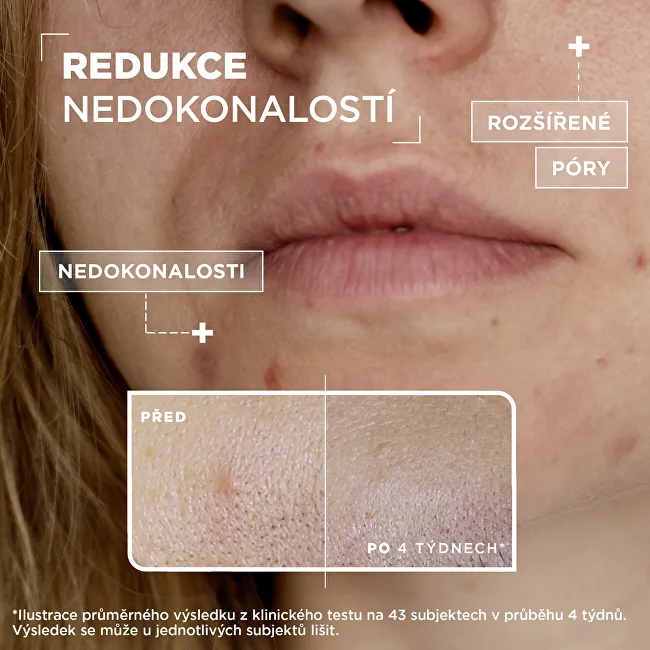 Mixa Salicylic acid + niacinamide anti-imperfection serum thumbnail 6