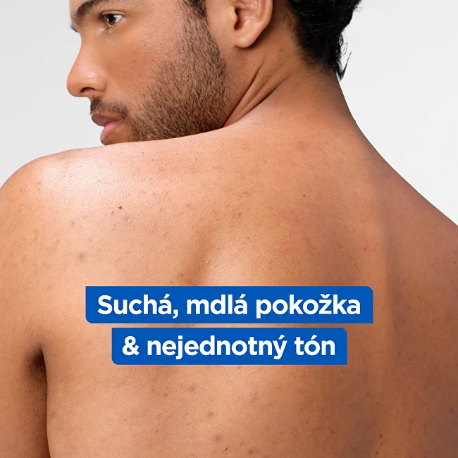 Mixa Body Lotion for Dry Skin Niacinamide Bright (Body Lotion) 250 ml thumbnail 4