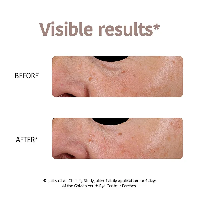 Iroha Golden Youth Eye Contour Patches 2 x thumbnail 3