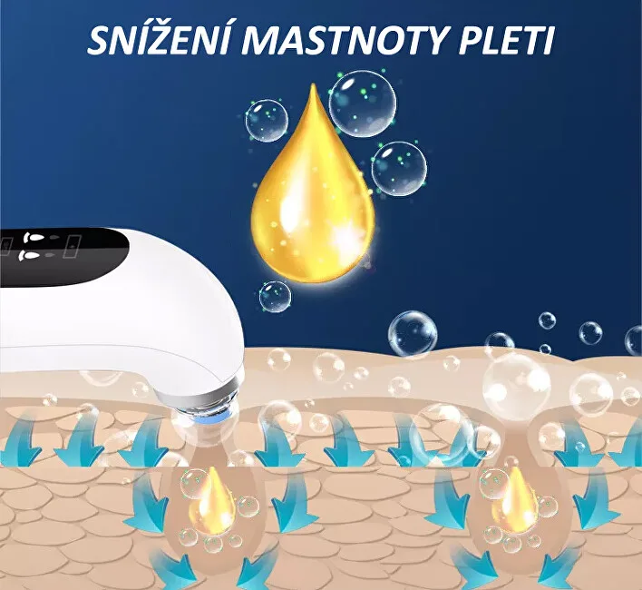 BeautyRelax Poremax Oxygen skin cleanser thumbnail 7